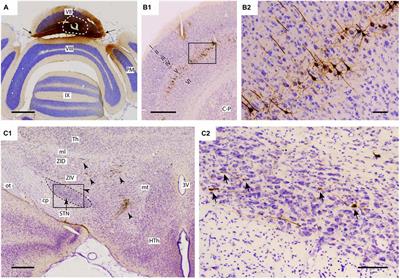 Disynaptic Subthalamic Input to the Posterior Cerebellum in Rat